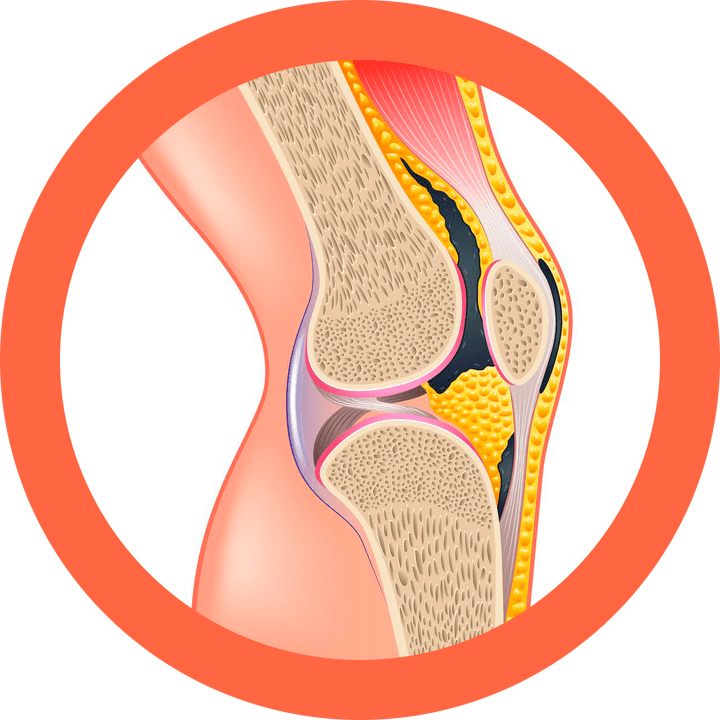 Hondroten - restaure les articulations et les muscles